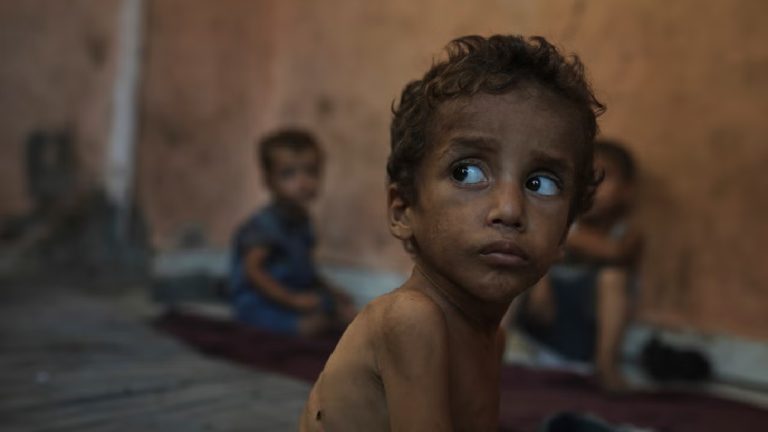 A close-up of a thin, young boy with curly hair looking off-camera in a dimly lit room.